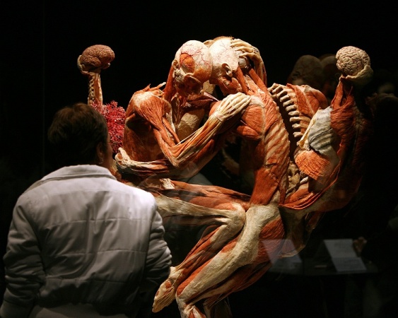 body1